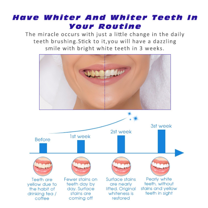 Smile White Strips